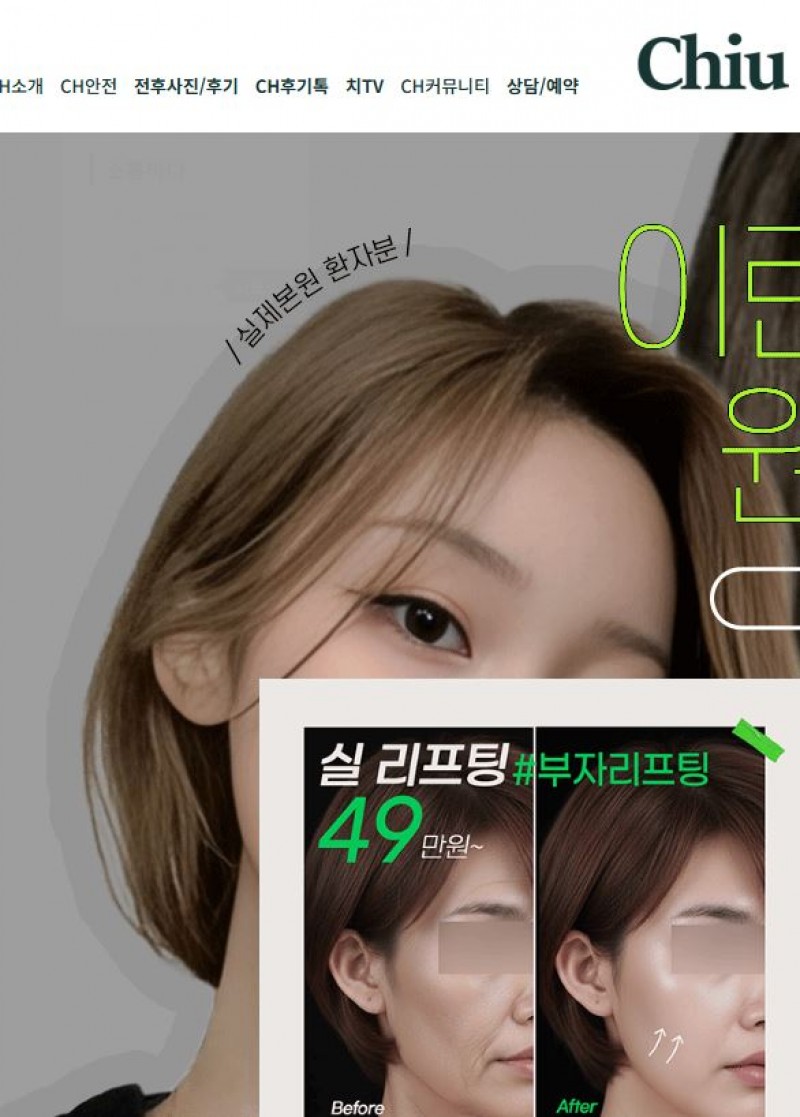 치유 성형외과
